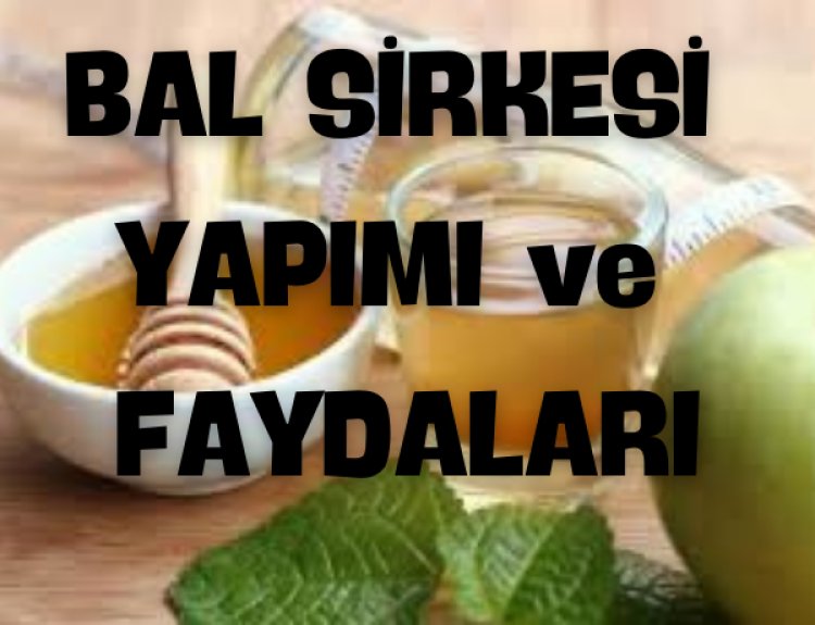 Bal Sirkesi
